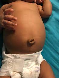 Baby S Tummy Big Help August 2018 Babies Forums What To Expect Page 2