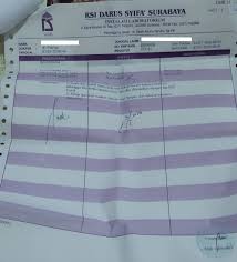 Untuk daftar npwp online ada 3 step penting, yaitu. Pengalaman Rapid Test Di Rumah Sakit Rezky Pratama Blog