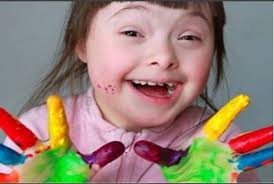 Unidos Por La Igualdad De Condiciones