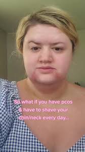 Empowering PCOS Girls with Farmasi Makeup Transformation