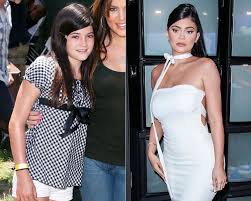 To revisit this article, visit my profile, thenview saved stories. Kylie Jenner Before And After Has She Had Work Done Photos Hollywood Life