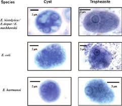 Pin By Isabel On Parasitologia Medical Laboratory Scientist Medical Laboratory Medical Laboratory Science