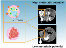 To understand how to prevent prostate cancer, one must first understand what causes it. Targeted Mri Could Pinpoint Aggressive Prostate Cancers Before They Spread Imaging Technology News