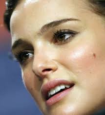 Seriously there are a lot of moley actors out there these days. 50 Unsightly Celebrity Moles Topless Robot