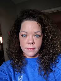 Hi guys what I using to bring back hair line back any advice please