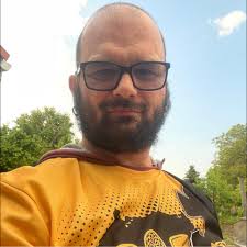 Chopped Arm PRANK 😂