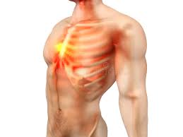 How to distinguish between cardiac and noncardiac causes. Male Anatomy Chest Pain Stock Illustration Illustration Of Heart 72849460