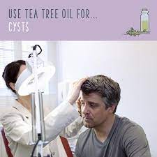 Tea Tree Oil Uses 70 Ways To Benefit From Tea Tree Oil Tea Tree Oil Uses Tea Tree Oil Face Tea Tree Oil