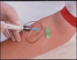 Once the vacuum tube is full of blood, remove the tourniquet. Syringe Used To Take Blood Sample Stock Image M532 0423 Science Photo Library