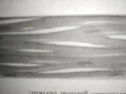 Jaringan darah merupakan jaringan ikat yang sangat khusus. Gambar Diatas Merupakan Jaringan A Otot Polos B Otot Lurik C Otot Jantung D Otot Serabut Brainly Co Id