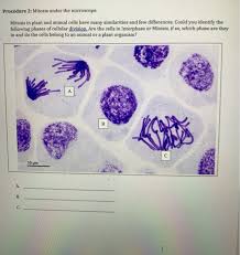 In the same year, mitosis in plants was described by strasburger. Procedure 2 Mitosis Under The Microscope Mitosis In Chegg Com