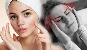 Sivilce Bas Agrisi Yapar Mi Sosyola