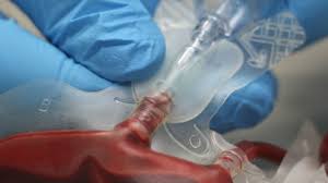 Image result for Blood Transfusion