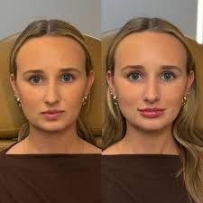 You can have it all at Boss Gal 💉✨