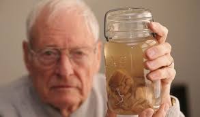 El pene de Napoleón Bonaparte y los ojos de Albert Einstein: las reliquias  más extrañas que atesora la historia