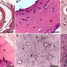 Compact bone, microscopically, is made of numerous osteons, whereas spongy bone is composed of sheets of lamellar bone and does not contain osteons. Histology Of Compact Bone In Birds Download Scientific Diagram