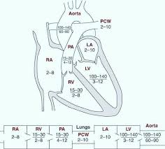 Pin By Jessica Sommer On Respiratory Cardiac Nursing