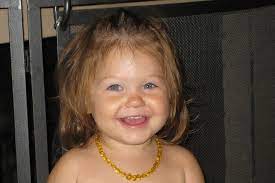 How to reverse tooth decay in babies. How To Reverse Tooth Decay My Daughter S Story