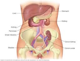 The decision to donate a kidney is just the first step on a journey that may eventually lead to a kidney transplant operation. Kidney Transplant Mayo Clinic