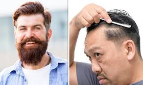 Treatments for hair loss include medications and surgery. Hair Loss Treatment Laser Therapy Benefits And Side Effects Explained Samachar Central