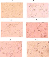 Image result for Elytraria acaulis