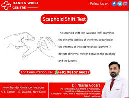 Image result for Scaphoid Shift Test