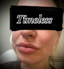 Winchester VA Medspa (@timeless_llc) · Instagram 照片和视频