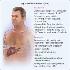 Pin By Lucas Junior On Did Someone Call A Nurse Fatty Liver Disease Cardiovascular System Fatty Liver