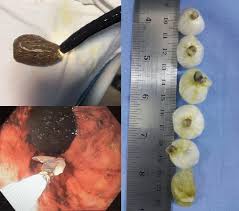 Image result for Body Stuffer