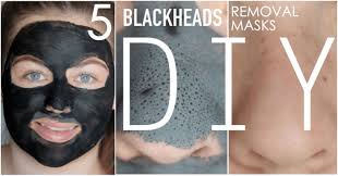 get rid of blackheads in 5 minutes