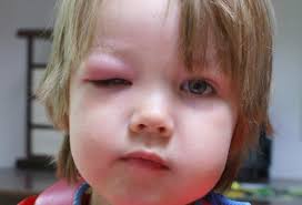 Kirpikleri uzun, sık ve yukarı bakan çocuklara dikkat!