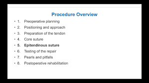 Image result for Elson Extensor Tendon Test