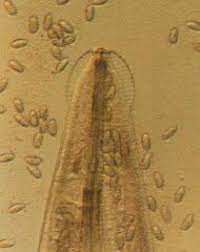 Lediglich in wenigen einzelfällen, z.b. Madenwurminfektion Eine Haufige Aber Wenig Beachtete Parasitose