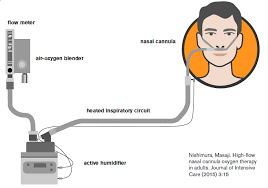 Nasal cannula • low flow device • most common device used for mild hypoxia • can be set between 1 and 6 lpm (24% to 40% fio2) • fio2 increases approximately 4% with each liter of o2 korupolur gj, needham dm.contemporary criticalcare. A Better Way To Treat Hypoxia Emergency Physicians Monthly