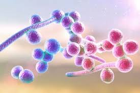 Image result for Candidiasis