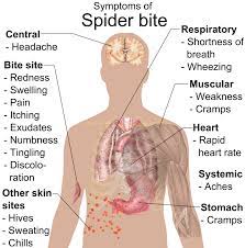 How black widow bite attacks? How To Identify Spider Bites Triangle Pest Control