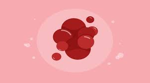 Darah Menggumpal Saat Menstruasi Normalkah
