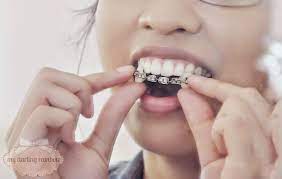 After Scrounging Online My Friend Who I Use In This Tutorial And I Weren T Able To Find How To M Nerd Costume Diy Diy Braces Best Friend Halloween Costumes