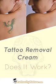 Everything You Need To Know About The Effectiveness Of Tattoo Removal Cream Tattoo Removal Cream Tattoo Removal Tattoos