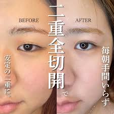 クマ取り脱脂/表ハムラ・裏ハムラ 藤澤 空彦