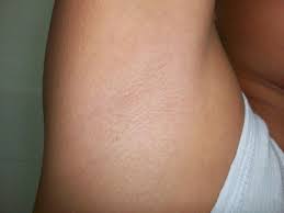Adds hair to armpits, pubes and bum crack. Pin On Genral Health Ha