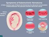 Image result for BLOOD CLOTS VS MISCARRIAGE