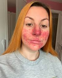 Skinlab Michael Perks