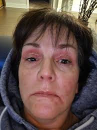 Why do some soaps make customers' eyes burn?