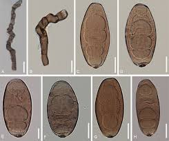 Image result for Pseudoeriosema borianii