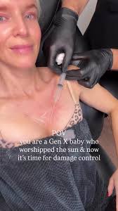 Collagen Boost Solutions for Gen X Skin Damage