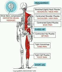 Atlas Chiropractic At Borer Family Chiropractic Accuracy And Precision Not Brute Strength Chiropractic Chiropractic Wellness Center Chiropractic Wellness
