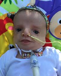 My son William had such a tough start in life. The first that we knew he  had #TreacherCollins was when he was born. In that moment, I knew that our  family and