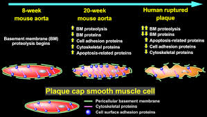 Since my librarian is a camel is a complex text, provide supports during work time to assist students in. Parallel Murine And Human Plaque Proteomics Reveals Pathways Of Plaque Rupture Circulation Research