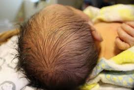 I have brown hair and green eyes and am of mixed eastern european descent, although i do have anyway, everyone's on my case about having a redheaded baby (because i clearly have control over that), so i'm trying to find statistical info on it. Biracial Baby Hair April 2018 Babies Forums What To Expect